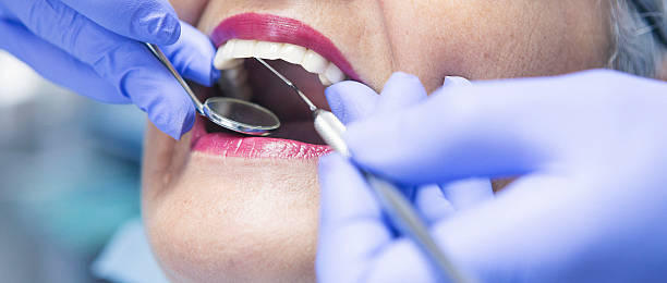 Best Emergency Dental Extractions in Johnson City, TX